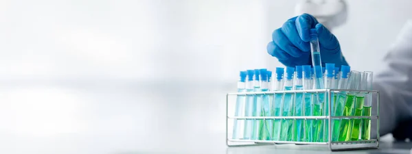 Stock image Lab assistant, a medical scientist, a chemistry researcher holds a glass tube through the blood sample, does a chemical experiment and examines a patient's blood sample. Medicine and research concept.