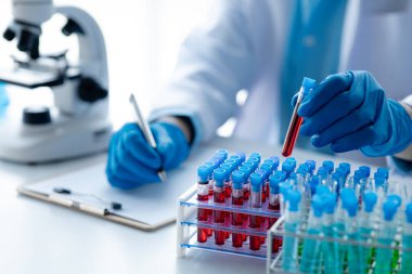 Laboratuvar asistanı, tıp bilimcisi, kimya araştırmacısı kan örneğinde cam bir tüp tutuyor, kimyasal bir deney yapıyor ve hastanın kan örneğini inceliyor. Tıp ve araştırma konsepti.