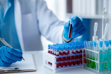 Laboratuvar asistanı, tıp bilimcisi, kimya araştırmacısı kan örneğinde cam bir tüp tutuyor, kimyasal bir deney yapıyor ve hastanın kan örneğini inceliyor. Tıp ve araştırma konsepti.