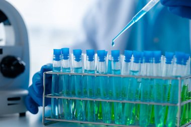 Laboratuvar asistanı, tıp bilimcisi, kimya araştırmacısı kan örneğinde cam bir tüp tutuyor, kimyasal bir deney yapıyor ve hastanın kan örneğini inceliyor. Tıp ve araştırma konsepti.