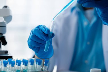 Laboratuvar asistanı, tıp bilimcisi, kimya araştırmacısı kan örneğinde cam bir tüp tutuyor, kimyasal bir deney yapıyor ve hastanın kan örneğini inceliyor. Tıp ve araştırma konsepti.