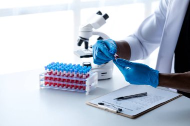 Laboratuvar asistanı, tıp bilimcisi, kimya araştırmacısı kan örneğinde cam bir tüp tutuyor, kimyasal bir deney yapıyor ve hastanın kan örneğini inceliyor. Tıp ve araştırma konsepti.