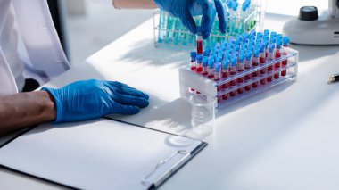 Laboratuvar asistanı, tıp bilimcisi, kimya araştırmacısı kan örneğinde cam bir tüp tutuyor, kimyasal bir deney yapıyor ve hastanın kan örneğini inceliyor. Tıp ve araştırma konsepti.