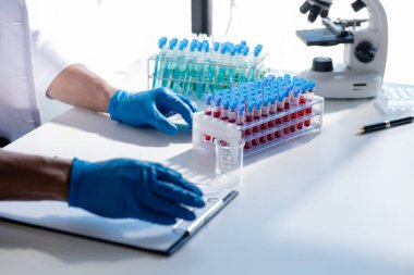 Laboratuvar asistanı, tıp bilimcisi, kimya araştırmacısı kan örneğinde cam bir tüp tutuyor, kimyasal bir deney yapıyor ve hastanın kan örneğini inceliyor. Tıp ve araştırma konsepti.