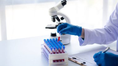 Laboratuvar asistanı, tıp bilimcisi, kimya araştırmacısı kan örneğinde cam bir tüp tutuyor, kimyasal bir deney yapıyor ve hastanın kan örneğini inceliyor. Tıp ve araştırma konsepti.