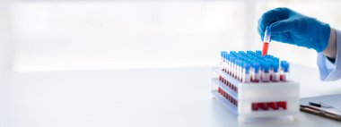 Laboratuvar asistanı, tıp bilimcisi, kimya araştırmacısı kan örneğinde cam bir tüp tutuyor, kimyasal bir deney yapıyor ve hastanın kan örneğini inceliyor. Tıp ve araştırma konsepti.