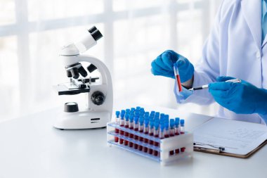 Laboratuvar asistanı, tıp bilimcisi, kimya araştırmacısı kan örneğinde cam bir tüp tutuyor, kimyasal bir deney yapıyor ve hastanın kan örneğini inceliyor. Tıp ve araştırma konsepti.