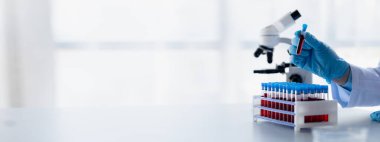 Laboratuvar asistanı, tıp bilimcisi, kimya araştırmacısı kan örneğinde cam bir tüp tutuyor, kimyasal bir deney yapıyor ve hastanın kan örneğini inceliyor. Tıp ve araştırma konsepti.