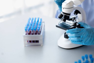Lab practitioner working on chemical research for chemical reactions, does a chemical experiment and examines a patient's blood sample. Medicine and research concept.