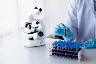 Laboratuvar asistanı, tıp bilimcisi, kimya araştırmacısı kan örneğinde cam bir tüp tutuyor, kimyasal bir deney yapıyor ve hastanın kan örneğini inceliyor. Tıp ve araştırma konsepti.
