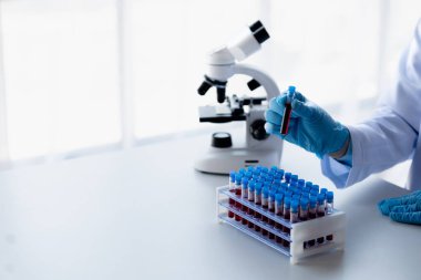 Laboratuvar asistanı, tıp bilimcisi, kimya araştırmacısı kan örneğinde cam bir tüp tutuyor, kimyasal bir deney yapıyor ve hastanın kan örneğini inceliyor. Tıp ve araştırma konsepti.
