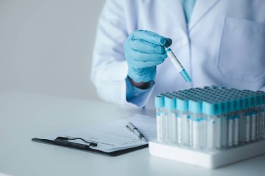 Lab assistant, a medical scientist, a chemistry researcher holds a glass tube through the blood sample, does a chemical experiment and examines a patient's blood sample. Medicine and research concept.