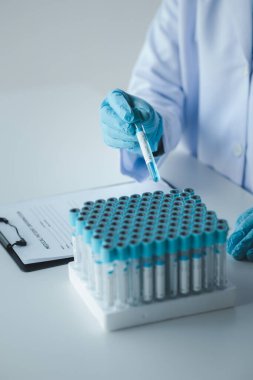 Laboratuvar asistanı, tıp bilimcisi, kimya araştırmacısı kan örneğinde cam bir tüp tutuyor, kimyasal bir deney yapıyor ve hastanın kan örneğini inceliyor. Tıp ve araştırma konsepti.