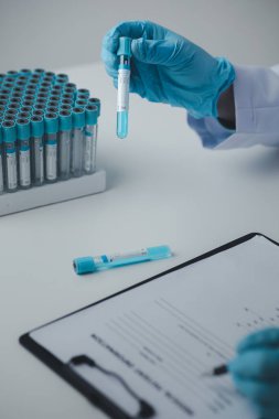 Laboratuvar asistanı, tıp bilimcisi, kimya araştırmacısı kan örneğinde cam bir tüp tutuyor, kimyasal bir deney yapıyor ve hastanın kan örneğini inceliyor. Tıp ve araştırma konsepti.