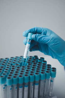 Lab assistant, a medical scientist, a chemistry researcher holds a glass tube through the blood sample, does a chemical experiment and examines a patient's blood sample. Medicine and research concept.