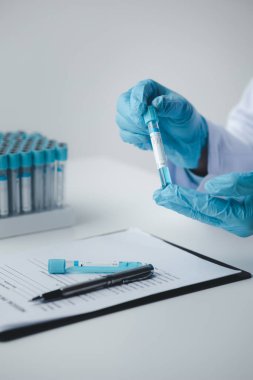 Lab assistant, a medical scientist, a chemistry researcher holds a glass tube through the blood sample, does a chemical experiment and examines a patient's blood sample. Medicine and research concept.