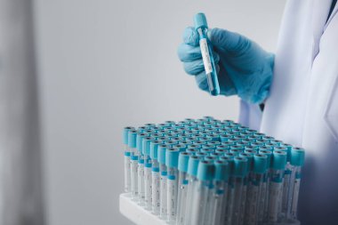 Laboratuvar asistanı, tıp bilimcisi, kimya araştırmacısı kan örneğinde cam bir tüp tutuyor, kimyasal bir deney yapıyor ve hastanın kan örneğini inceliyor. Tıp ve araştırma konsepti.