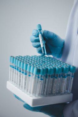 Lab assistant, a medical scientist, a chemistry researcher holds a glass tube through the blood sample, does a chemical experiment and examines a patient's blood sample. Medicine and research concept.