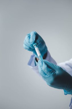 Lab assistant, a medical scientist, a chemistry researcher holds a glass tube through the blood sample, does a chemical experiment and examines a patient's blood sample. Medicine and research concept.