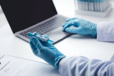 Laboratuvar asistanı, tıp bilimcisi, kimya araştırmacısı kan örneğinde cam bir tüp tutuyor, kimyasal bir deney yapıyor ve hastanın kan örneğini inceliyor. Tıp ve araştırma konsepti.