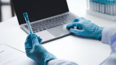 Laboratuvar asistanı, tıp bilimcisi, kimya araştırmacısı kan örneğinde cam bir tüp tutuyor, kimyasal bir deney yapıyor ve hastanın kan örneğini inceliyor. Tıp ve araştırma konsepti.