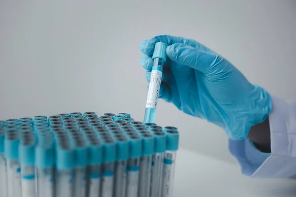 Lab Assistant Medical Scientist Chemistry Researcher Holds Glass Tube Blood —  Fotos de Stock
