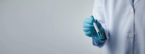 Lab Assistant Medical Scientist Chemistry Researcher Holds Glass Tube Blood — Stok fotoğraf