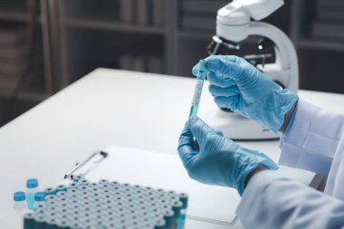 Laboratuvar asistanı, tıp bilimcisi, kimya araştırmacısı kimyasal test tüpünden cam bir tüp tutuyor, kimyasal deney yapıyor ve hastanın örneğini inceliyor. Tıp ve araştırma konsepti.