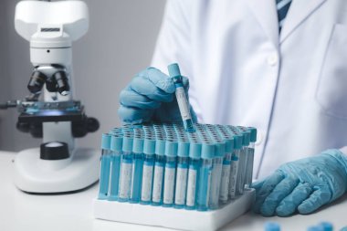 Laboratuvar asistanı, tıp bilimcisi, kimya araştırmacısı kimyasal test tüpünden cam bir tüp tutuyor, kimyasal deney yapıyor ve hastanın örneğini inceliyor. Tıp ve araştırma konsepti.