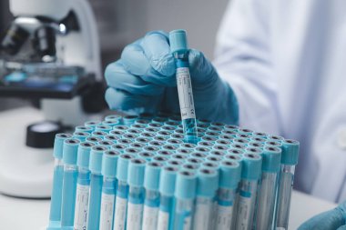 Laboratuvar asistanı, tıp bilimcisi, kimya araştırmacısı kimyasal test tüpünden cam bir tüp tutuyor, kimyasal deney yapıyor ve hastanın örneğini inceliyor. Tıp ve araştırma konsepti.