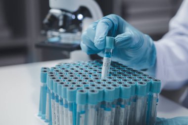 Laboratuvar asistanı, tıp bilimcisi, kimya araştırmacısı kimyasal test tüpünden cam bir tüp tutuyor, kimyasal deney yapıyor ve hastanın örneğini inceliyor. Tıp ve araştırma konsepti.