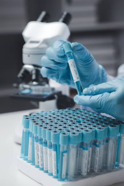 Laboratuvar asistanı, tıp bilimcisi, kimya araştırmacısı kimyasal test tüpünden cam bir tüp tutuyor, kimyasal deney yapıyor ve hastanın örneğini inceliyor. Tıp ve araştırma konsepti.