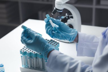 Laboratuvar asistanı, tıp bilimcisi, kimya araştırmacısı kimyasal test tüpünden cam bir tüp tutuyor, kimyasal deney yapıyor ve hastanın örneğini inceliyor. Tıp ve araştırma konsepti.