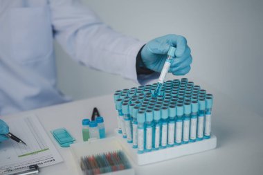 Laboratuvar asistanı, tıp bilimcisi, kimya araştırmacısı kimyasal test tüpünden cam bir tüp tutuyor, kimyasal deney yapıyor ve hastanın örneğini inceliyor. Tıp ve araştırma konsepti.