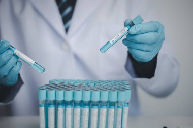 Laboratuvar asistanı, tıp bilimcisi, kimya araştırmacısı kimyasal test tüpünden cam bir tüp tutuyor, kimyasal deney yapıyor ve hastanın örneğini inceliyor. Tıp ve araştırma konsepti.