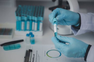 Laboratuvar asistanı, tıp bilimcisi, kimya araştırmacısı kimyasal test tüpünden cam bir tüp tutuyor, kimyasal deney yapıyor ve hastanın örneğini inceliyor. Tıp ve araştırma konsepti.