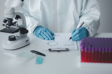Laboratuvar, hastaneden alınan kan örneklerinin incelenmesi ve incelenmesi için bilimsel araştırmalarda kullanılıyor. Laboratuvar asistanı anormallikler için kan testleri yapıyor. Laboratuvar ve uzman kavramları.