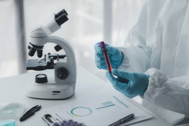 Laboratuvar, hastaneden alınan kan örneklerinin incelenmesi ve incelenmesi için bilimsel araştırmalarda kullanılıyor. Laboratuvar asistanı anormallikler için kan testleri yapıyor. Laboratuvar ve uzman kavramları.
