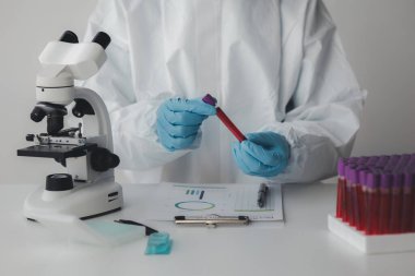 Laboratuvar, hastaneden alınan kan örneklerinin incelenmesi ve incelenmesi için bilimsel araştırmalarda kullanılıyor. Laboratuvar asistanı anormallikler için kan testleri yapıyor. Laboratuvar ve uzman kavramları.