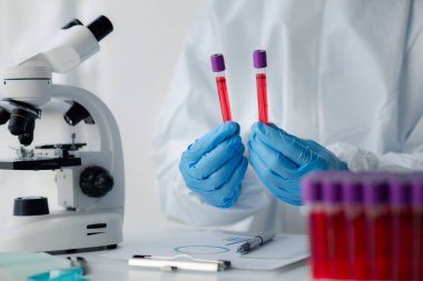 Laboratuvar, hastaneden alınan kan örneklerinin incelenmesi ve incelenmesi için bilimsel araştırmalarda kullanılıyor. Laboratuvar asistanı anormallikler için kan testleri yapıyor. Laboratuvar ve uzman kavramları.