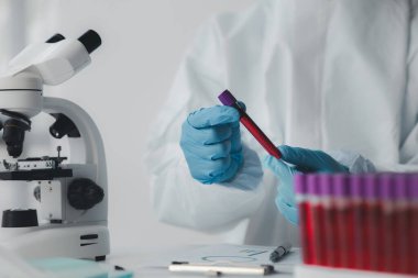 Laboratuvar, hastaneden alınan kan örneklerinin incelenmesi ve incelenmesi için bilimsel araştırmalarda kullanılıyor. Laboratuvar asistanı anormallikler için kan testleri yapıyor. Laboratuvar ve uzman kavramları.
