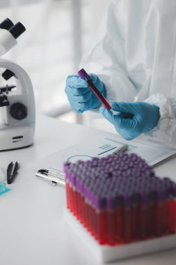 Laboratuvar, hastaneden alınan kan örneklerinin incelenmesi ve incelenmesi için bilimsel araştırmalarda kullanılıyor. Laboratuvar asistanı anormallikler için kan testleri yapıyor. Laboratuvar ve uzman kavramları.