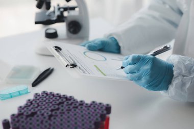 Laboratuvar, hastaneden alınan kan örneklerinin incelenmesi ve incelenmesi için bilimsel araştırmalarda kullanılıyor. Laboratuvar asistanı anormallikler için kan testleri yapıyor. Laboratuvar ve uzman kavramları.