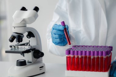 Laboratuvar, hastanelerden alınan hastaların ve laboratuvar asistanlarının hastalardan kan örnekleri toplayarak elde edilen kan örneklerini incelemek ve araştırmak için bilimsel araştırmalarda kullanılır. Laboratuvar kavramı.