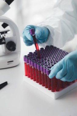 Laboratuvar, hastanelerden alınan hastaların ve laboratuvar asistanlarının hastalardan kan örnekleri toplayarak elde edilen kan örneklerini incelemek ve araştırmak için bilimsel araştırmalarda kullanılır. Laboratuvar kavramı.
