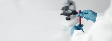 Laboratuvar, hastanelerden alınan hastaların ve laboratuvar asistanlarının hastalardan kan örnekleri toplayarak elde edilen kan örneklerini incelemek ve araştırmak için bilimsel araştırmalarda kullanılır. Laboratuvar kavramı.