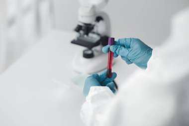 Laboratuvar, hastanelerden alınan hastaların ve laboratuvar asistanlarının hastalardan kan örnekleri toplayarak elde edilen kan örneklerini incelemek ve araştırmak için bilimsel araştırmalarda kullanılır. Laboratuvar kavramı.
