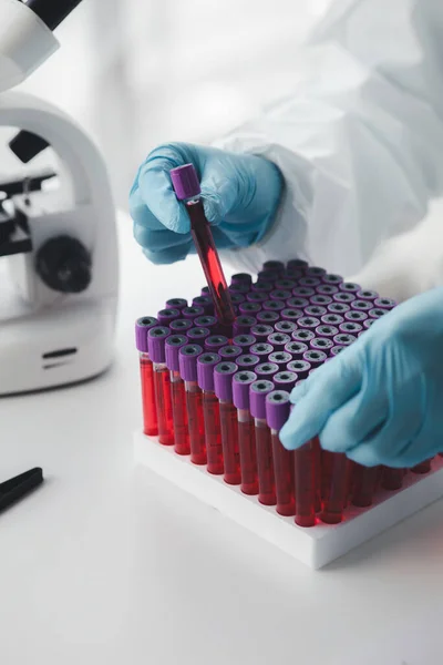 Laboratorio Utiliza Para Investigación Científica Para Examinar Investigar Sangre Obtenida —  Fotos de Stock