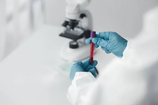 Laboratorio Utiliza Para Investigación Científica Para Examinar Investigar Sangre Obtenida —  Fotos de Stock