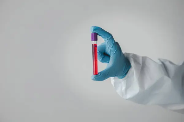 Лабораторія Використовується Наукових Досліджень Вивчення Дослідження Крові Отриманої Допомогою Зразків — стокове фото